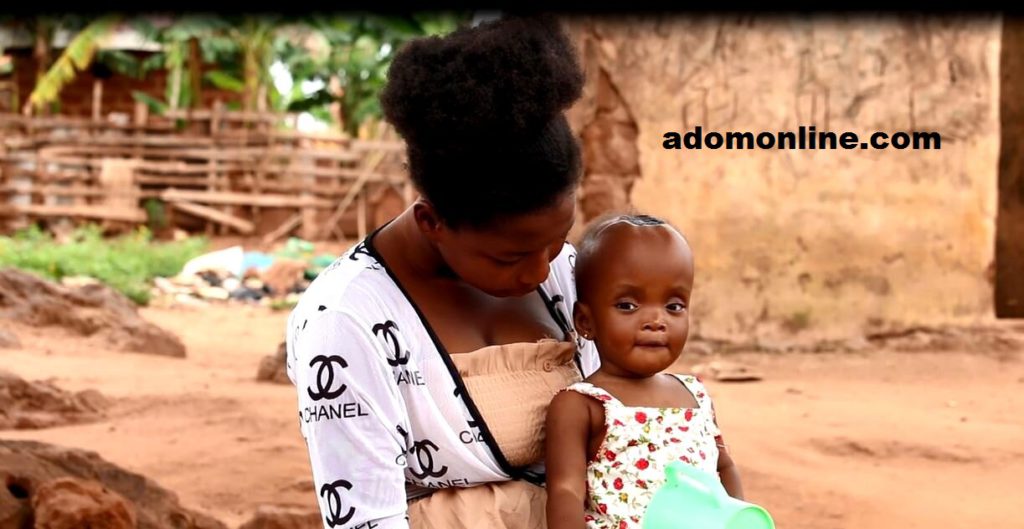 The 11-month old baby has abnormal large head and growth at the back.