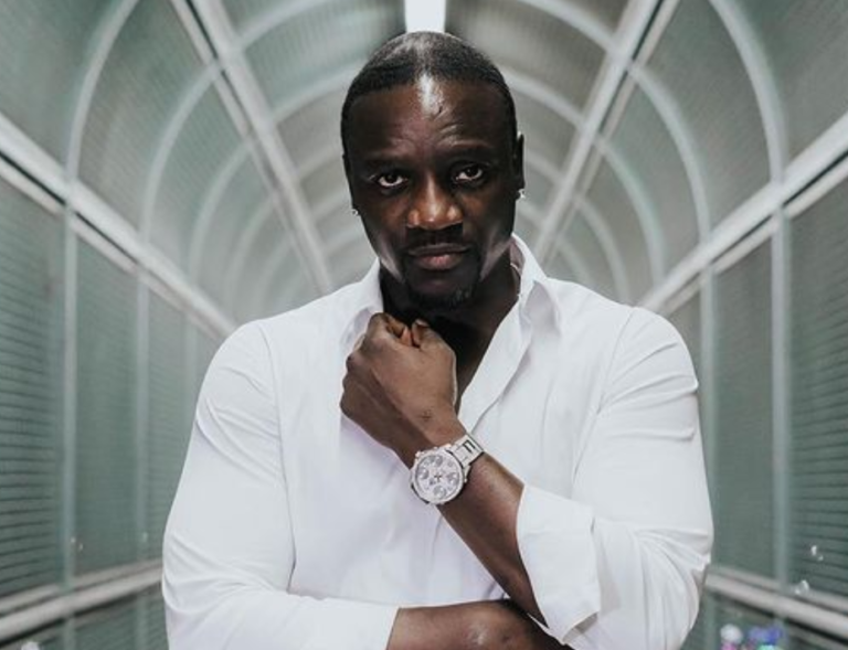 Akon reveals he got a hair transplant worth $7,500