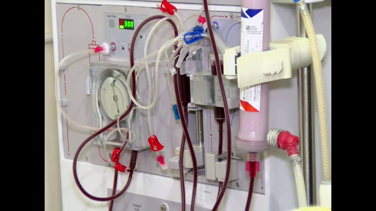 NHIS announces free Dialysis Treatment at 24 accredited Hospitals