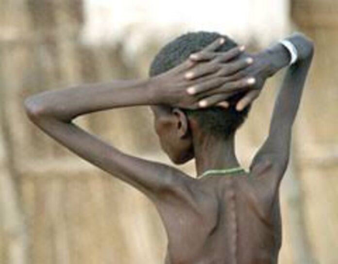 Conflict in Bawku worsens malnutrition crisis, claims two lives 